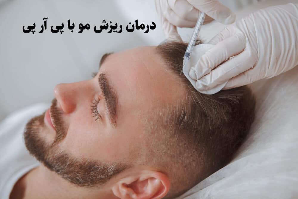 درمان ریزش مو با روش پی آر پی
