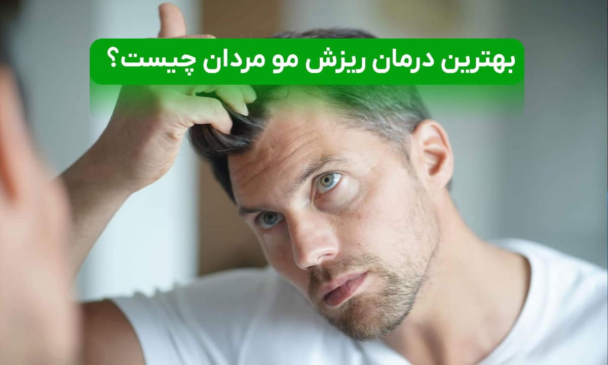 بهترین درمان ریزش مو مردان چیست؟