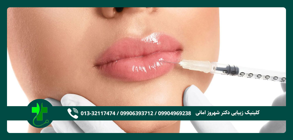 تزریق ژل لب در رشت