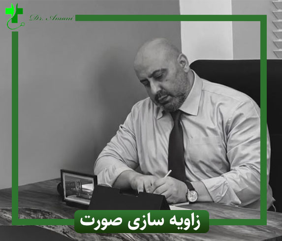 زاویه سازی صورت در رشت