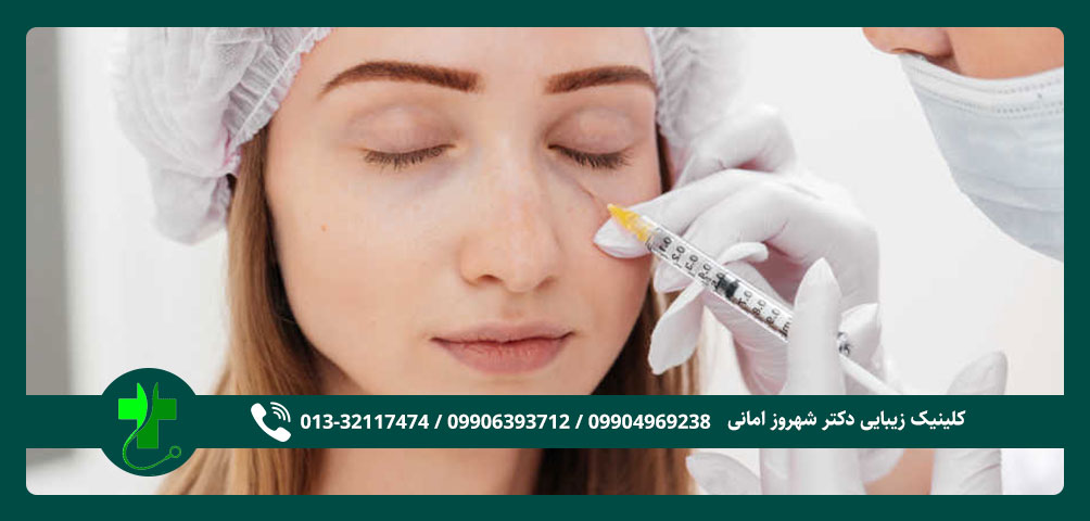 تزریق ژل زیر چشم در رشت