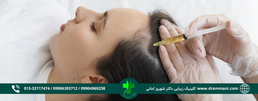 مزوتراپی در رشت