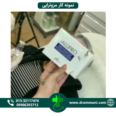 نمونه کار تزریق مزوژل در رشت