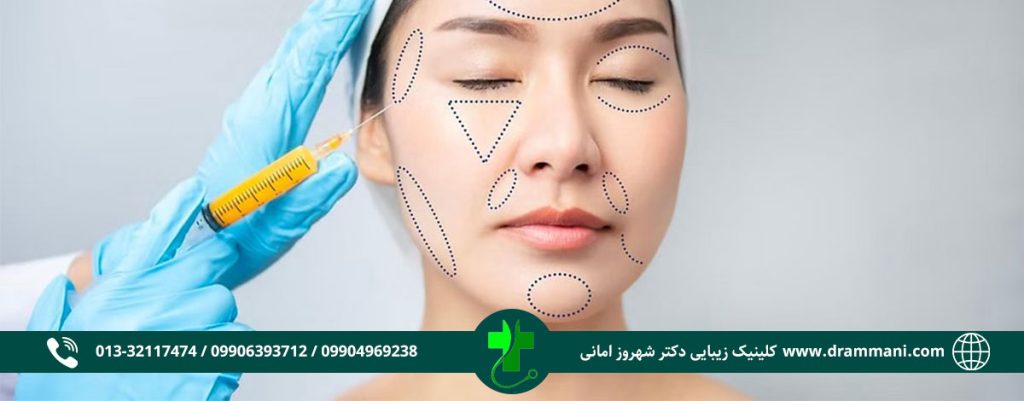 تزریق چربی در رشت
