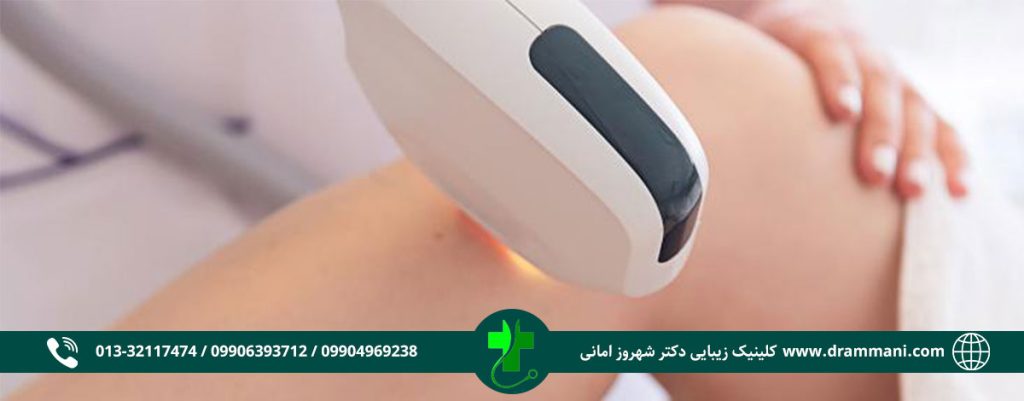 لیزر موهای زائد دکتر امانی رشت