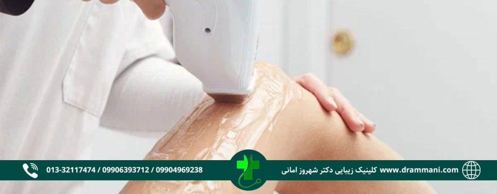 لیزر موهای زائد دکتر امانی رشت