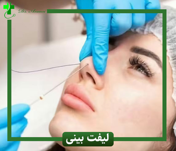 لیفت بینی در رشت