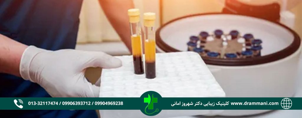 پی آر پی مو و صورت در رشت
