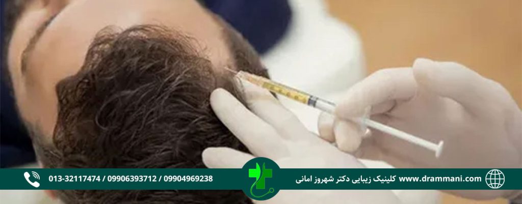 پی آر پی مو در رشت