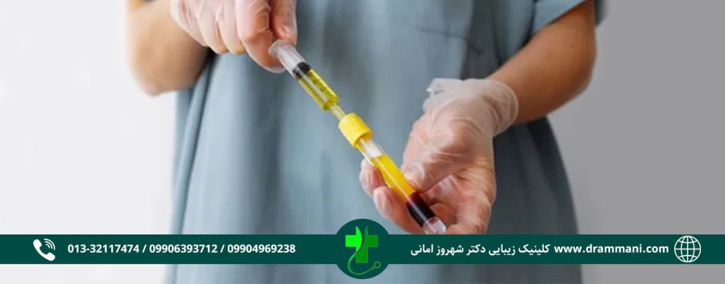 پی آر پی مو و صورت در رشت