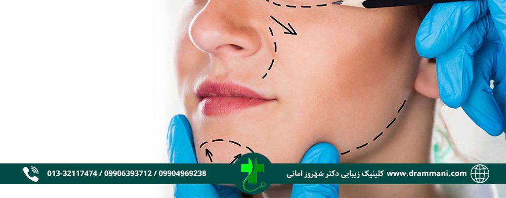 بوکال فت دکتر امانی رشت