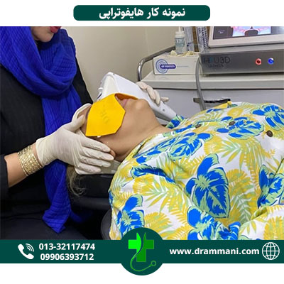 نمونه کار هایفوتراپی دکتر امانی