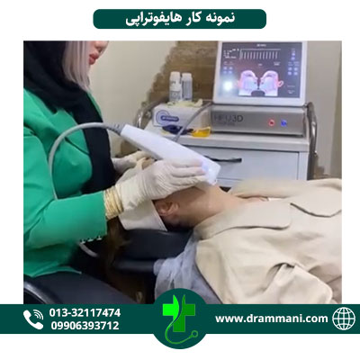 نمونه کار هایفوتراپی دکتر امانی