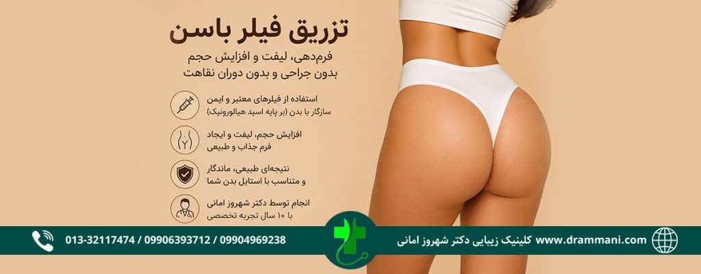 فیلر باسن چیست؟