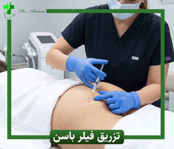 تزریق فیلر باسن در رشت
